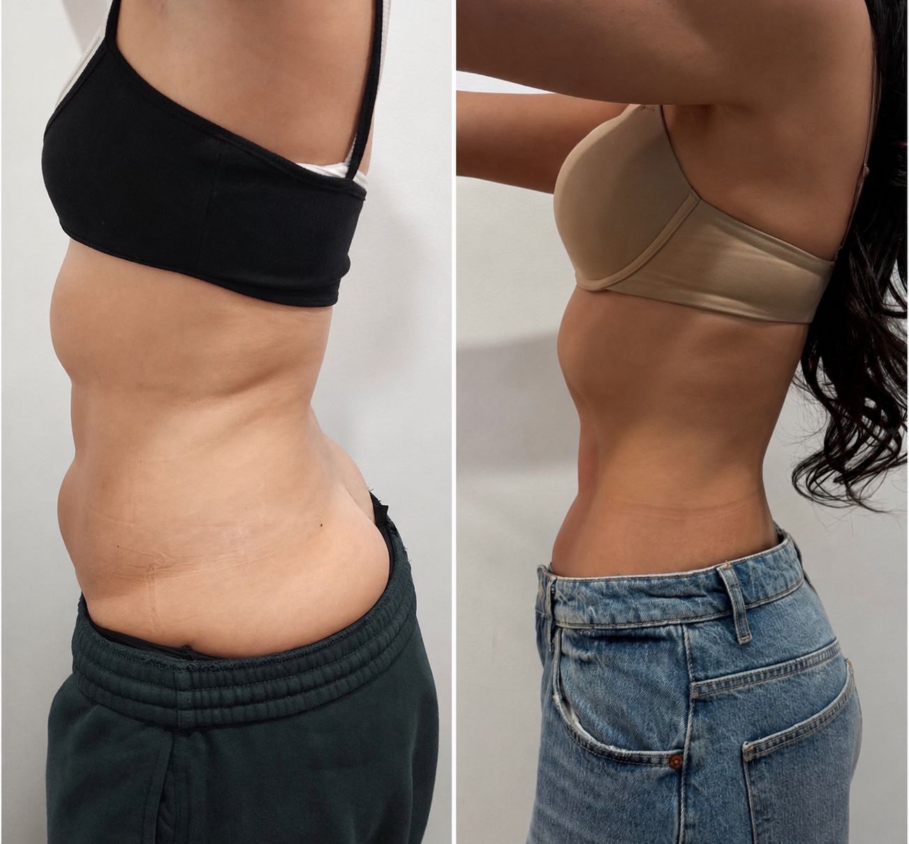 Waist & side profile transformation