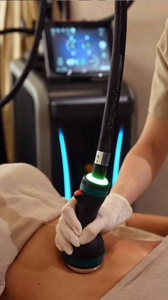 Onda Pro Coolwaves treatment in session at HADA Aesthetics